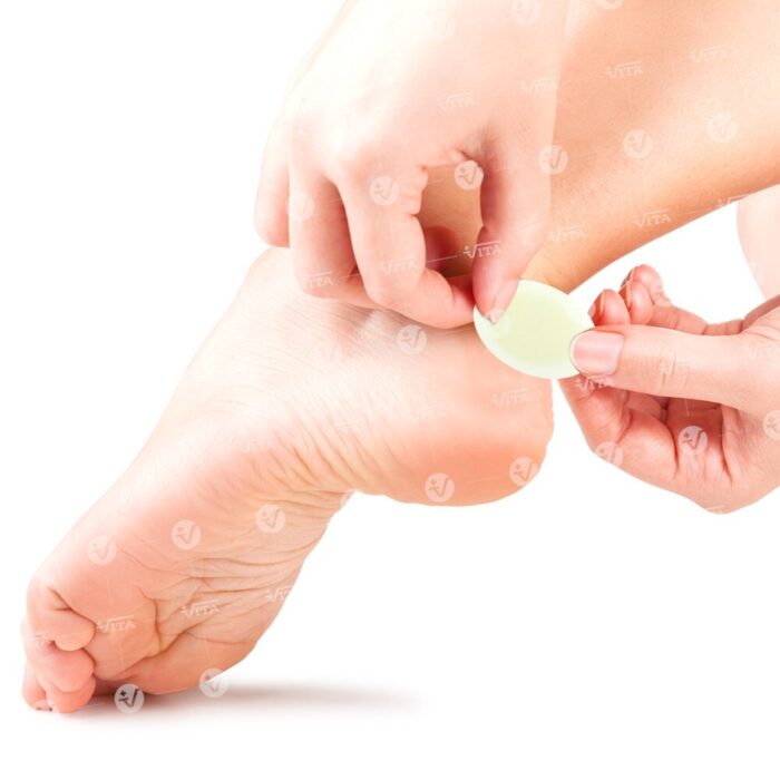 Vita Deramed Επιθέματα Αυτοκόλλητα Προστατευτικά Gel (5τεμ.) F-00059-01C 07-2-066 - Image 2